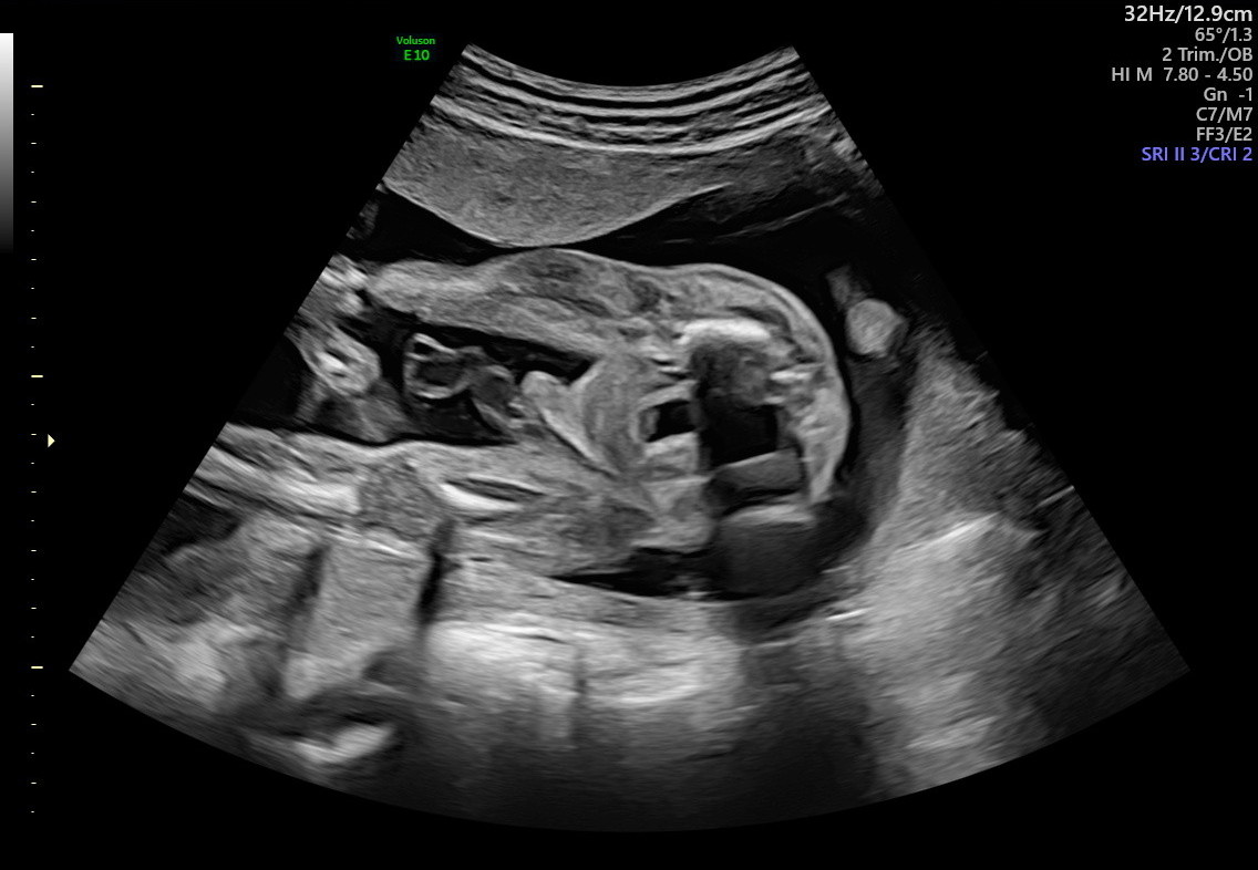 1.2.276.0.26.1.1.1.2.2022.324.29928.2671405.92012544