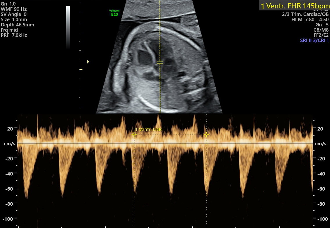 1.2.276.0.26.1.1.1.2.2022.324.30049.4512692.92012544