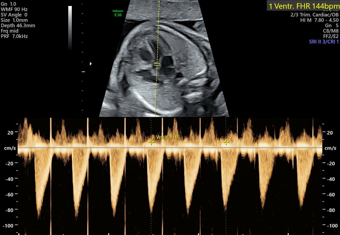 1.2.276.0.26.1.1.1.2.2022.324.30164.765313.92012544