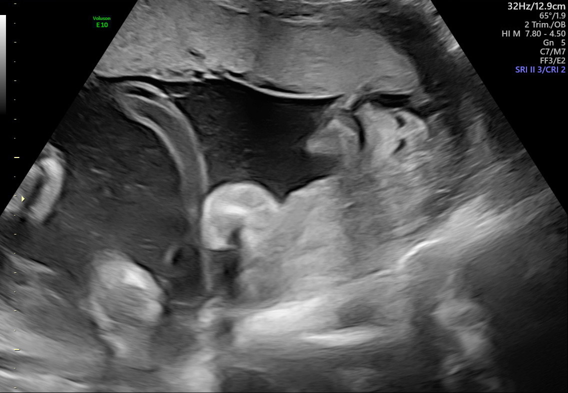 1.2.276.0.26.1.1.1.2.2022.324.30239.7487419.92012544