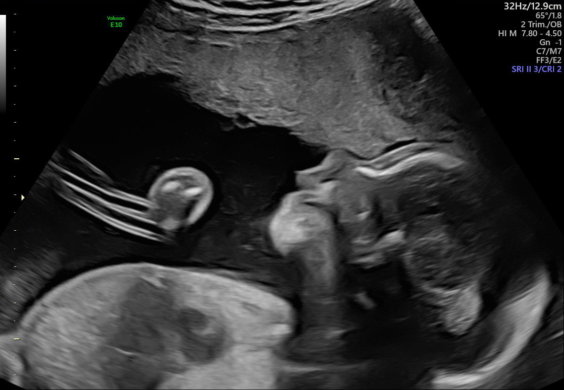 1.2.276.0.26.1.1.1.2.2022.324.30360.2387771.92012544