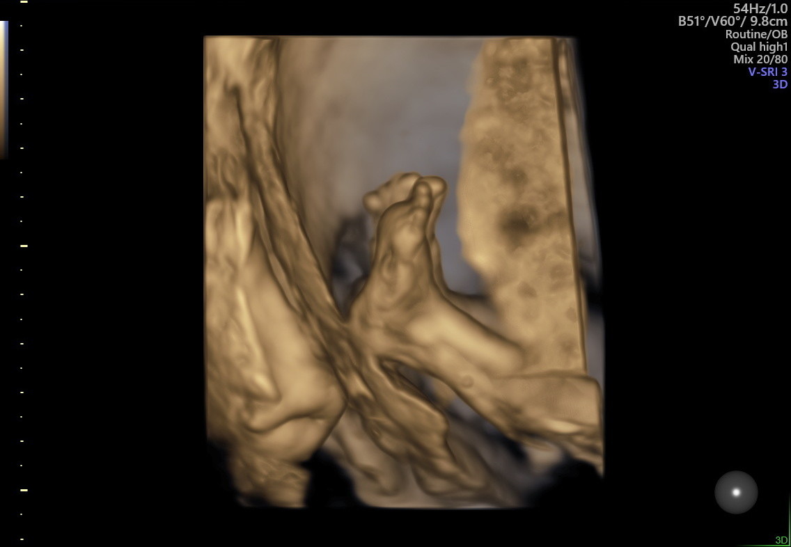 1.2.276.0.26.1.1.1.2.2022.324.30425.1080696.92012544