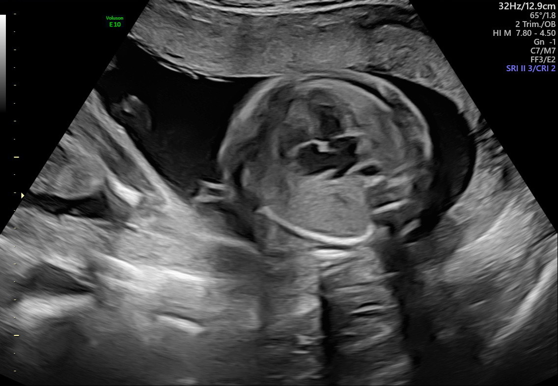 1.2.276.0.26.1.1.1.2.2022.324.30511.6477323.92012544