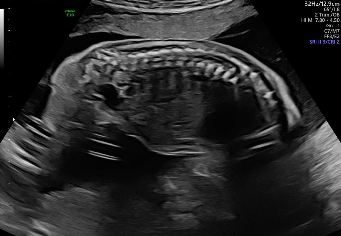 1.2.276.0.26.1.1.1.2.2022.324.30530.1932913.92012544