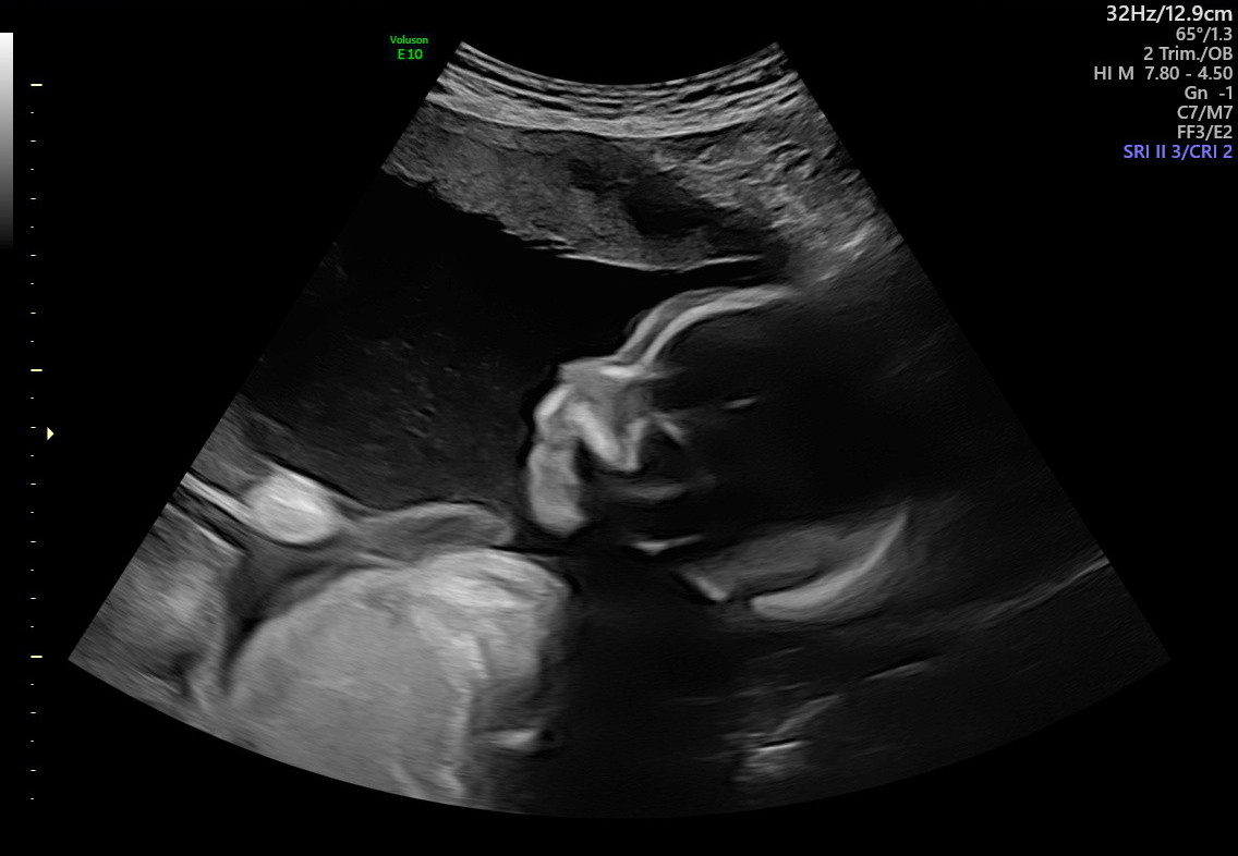 1.2.276.0.26.1.1.1.2.2022.324.30757.399127.92012544