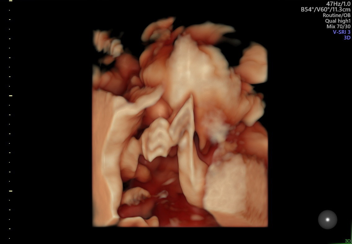 1.2.276.0.26.1.1.1.2.2022.324.30810.989542.92012544