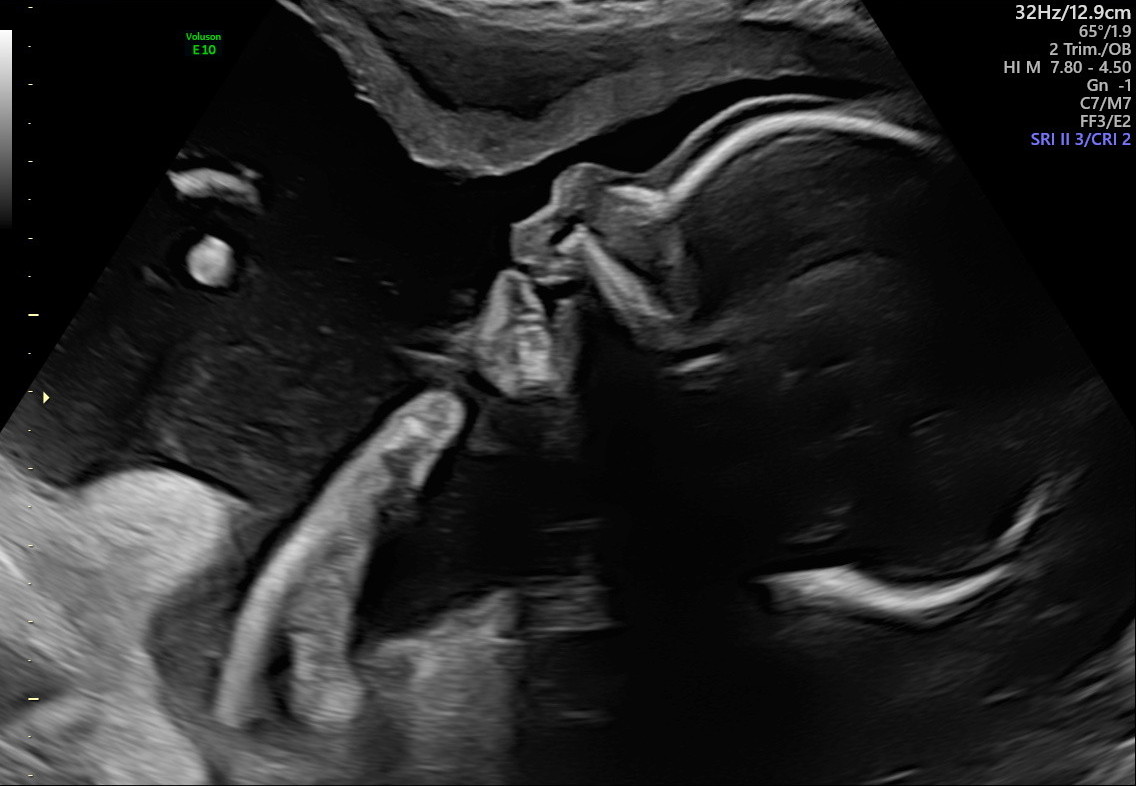 1.2.276.0.26.1.1.1.2.2022.324.30845.8124259.92012544