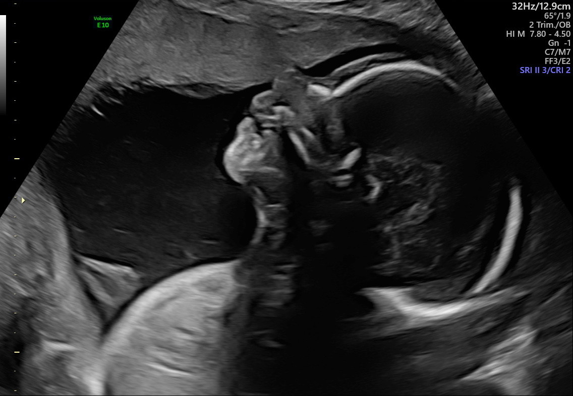 1.2.276.0.26.1.1.1.2.2022.324.30897.291695.92012544