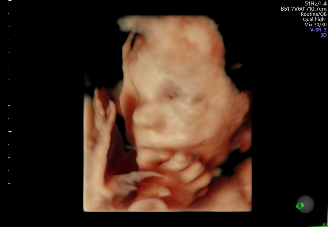 1.2.276.0.26.1.1.1.2.2022.324.30942.6093354.92012544