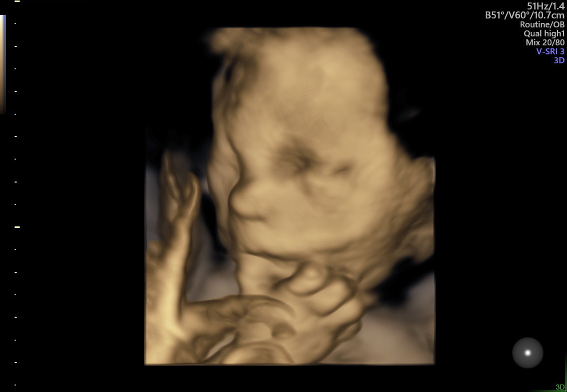 1.2.276.0.26.1.1.1.2.2022.324.30949.4619319.92012544