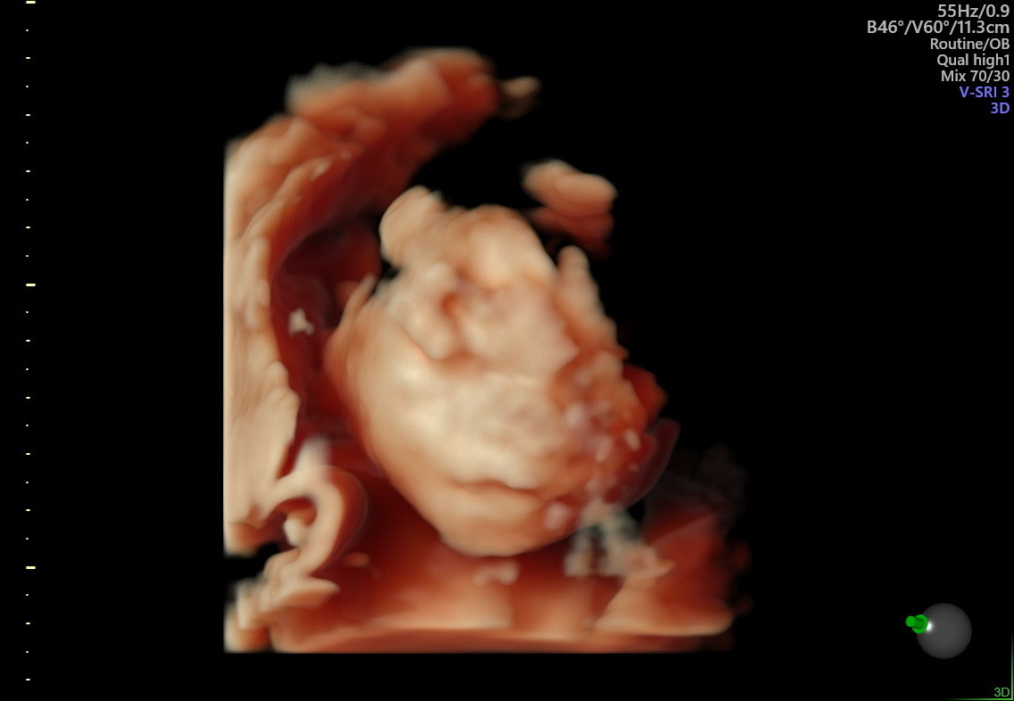 1.2.276.0.26.1.1.1.2.2022.324.31002.6175682.92012544